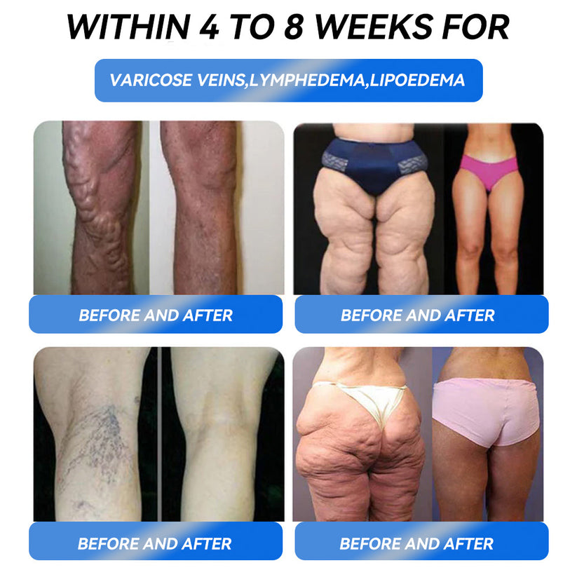 Honxi® ⚡GLP-1 Max Weight Loss Oral Solution ✅One dose a day — see results in 7 days 👩⚕️Suitable for obesity, cardiovascular diseases, diabetes, sleep apnea, high cholesterol and blood lipids, joint problems, and various other conditions🚀