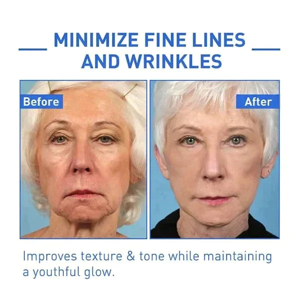 Hudros™ Botox Facial Essence (🔥Last Day Promotion 80% OFF)