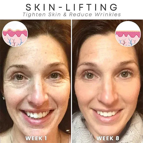 Hudros™ Botox Facial Essence (🔥Last Day Promotion 80% OFF)