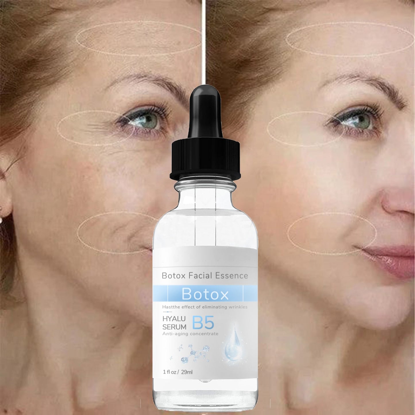 Hudros™ Botox Facial Essence (🔥Last Day Promotion 80% OFF)