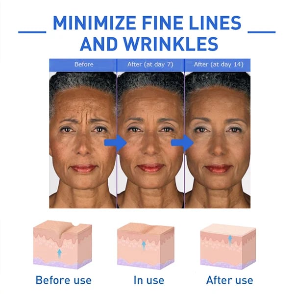 Hudros™ Botox Facial Essence (🔥Last Day Promotion 80% OFF)