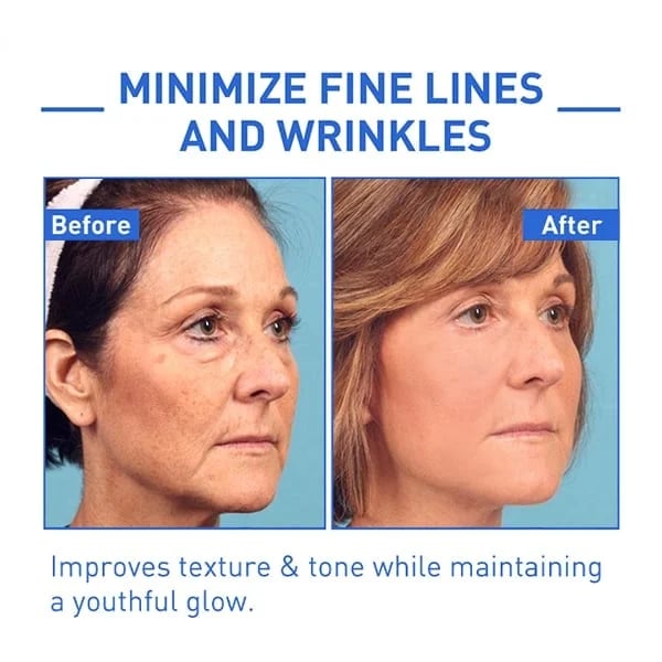 Hudros™ Botox Facial Essence (🔥Last Day Promotion 80% OFF)