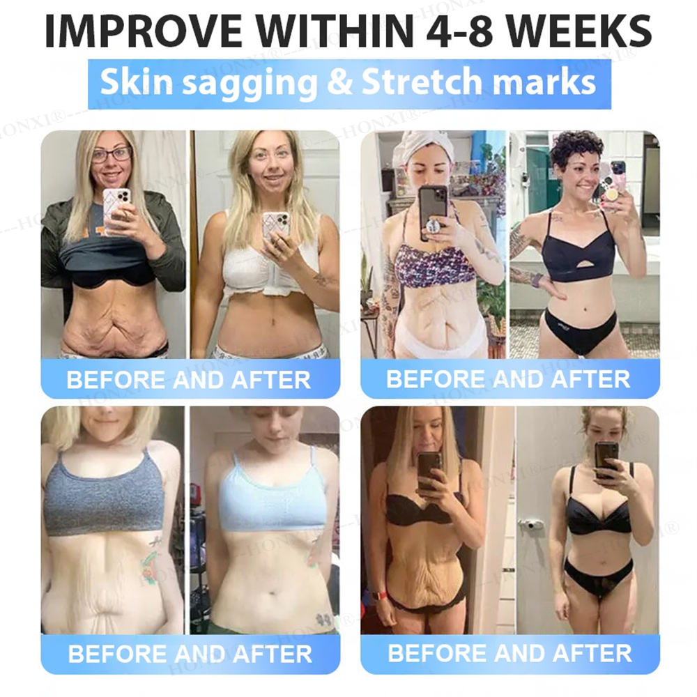 🏥FDA Store | HONXI® Slimming & Health  Nanoparticle Patch with Collagen & Matrixyl 3000 丨Obesity,Cardiovascular Diseas, Diabetes, Sleep Apnea, Joint Problems and More