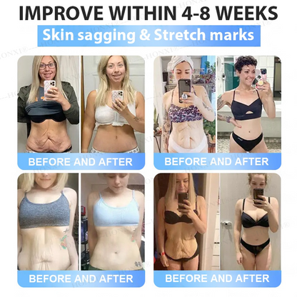 🏥FDA Store | HONXI® Slimming & Health  Nanoparticle Patch with Collagen & Matrixyl 3000 丨Obesity,Cardiovascular Diseas, Diabetes, Sleep Apnea, Joint Problems and More