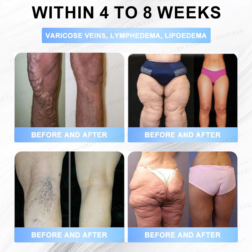 🏥FDA Store | HONXI® Slimming & Health  Nanoparticle Patch with Collagen & Matrixyl 3000 丨Obesity,Cardiovascular Diseas, Diabetes, Sleep Apnea, Joint Problems and More