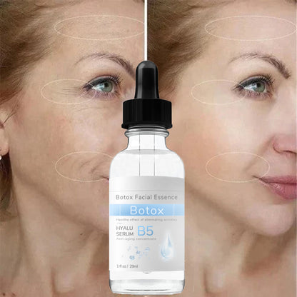 Hudros™ Botox Facial Essence (🔥Last Day Promotion 80% OFF)