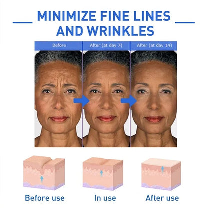 Hudros™ Botox Facial Essence (🔥Last Day Promotion 80% OFF)