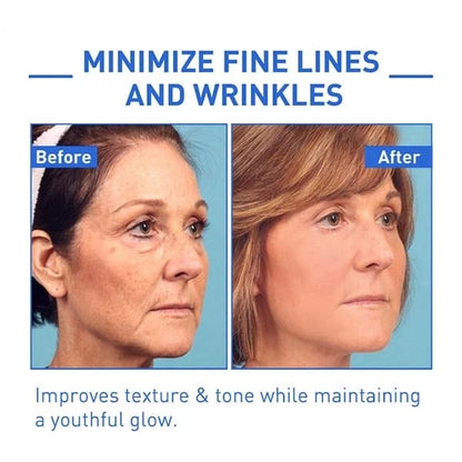 Hudros™ Botox Facial Essence (🔥Last Day Promotion 80% OFF)